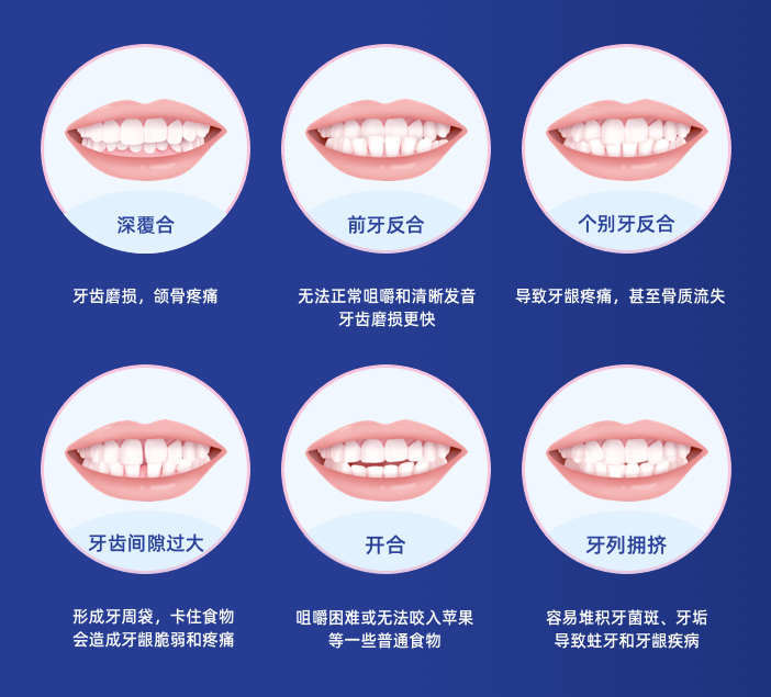 提醒！深圳新增一笔500-4000元补助，非深户也能领