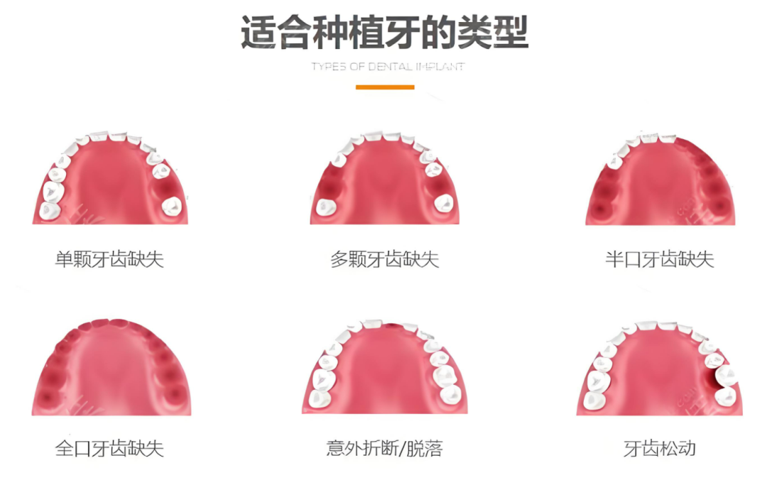 联合发放！深圳新增一笔补助，覆盖所有在深家庭！