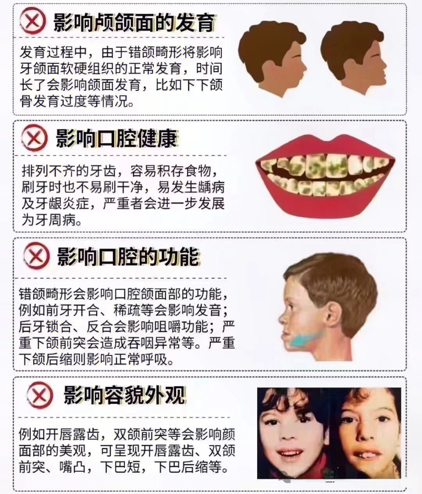 【暑期矫正季】儿牙护牙治牙和牙齿矫正福利看这里
